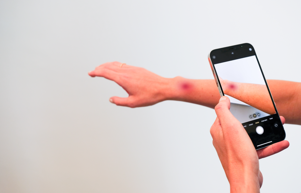 Hautarzt In Der Nähe Ohne Termin Ohne Termin schnell in die Hautarztpraxis? Das geht!