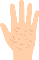 Trockene Hand