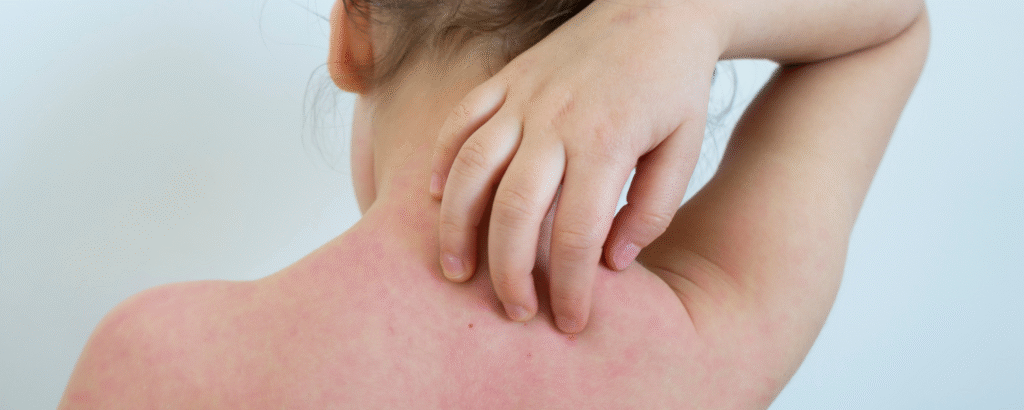 Kind kratzt sich am Rücken